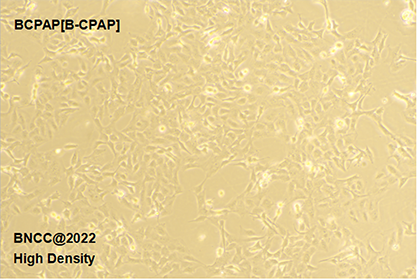 Human thyroid papillary cancer cell-BNCC