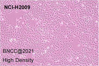 Human lung adenocarcinoma cells-BNCC