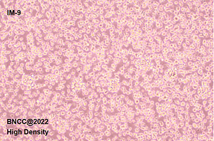 Human peripheral blood B lymphocytes-BNCC