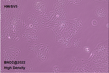 Human peritoneal mesothelial cells-BNCC
