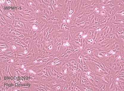 Immortalized cells of human normal prostate stroma-BNCC