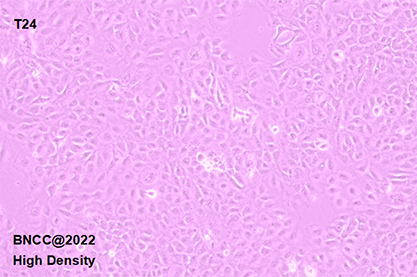 Human bladder transitional cell cancer cells-BNCC