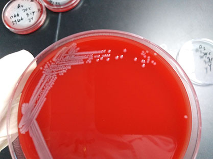 Escherichia coli-BNCC