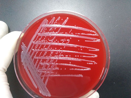 Escherichia coli-BNCC