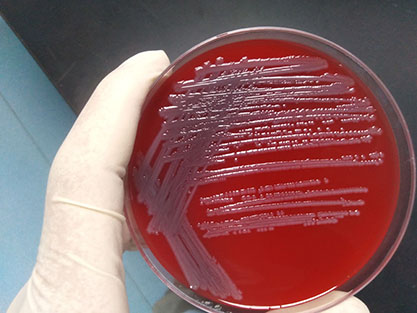 Escherichia coli-BNCC