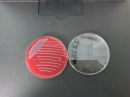 Escherichia coli-BNCC