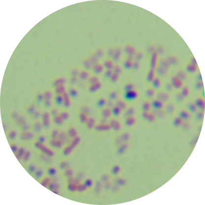 Escherichia coli-BNCC