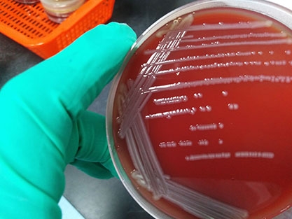 Escherichia coli-BNCC