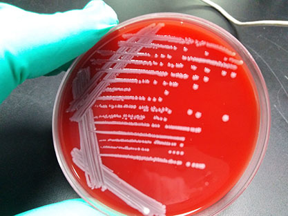 Escherichia coli-BNCC