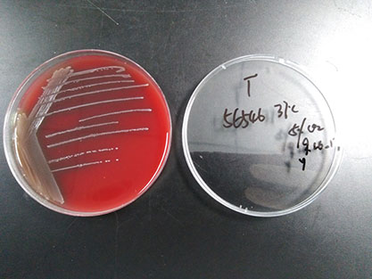 Enterococcus faecium-BNCC