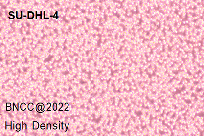 Human B- cell lymphoma cells-BNCC