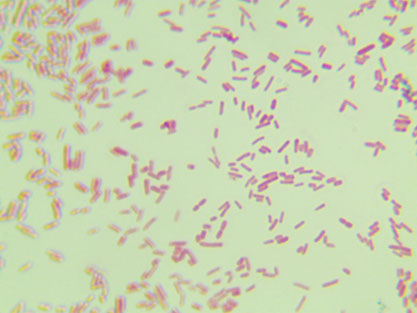 Escherichia coli-BNCC