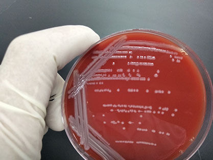 Escherichia coli-BNCC