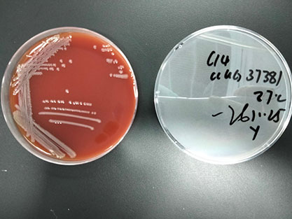 Escherichia coli-BNCC