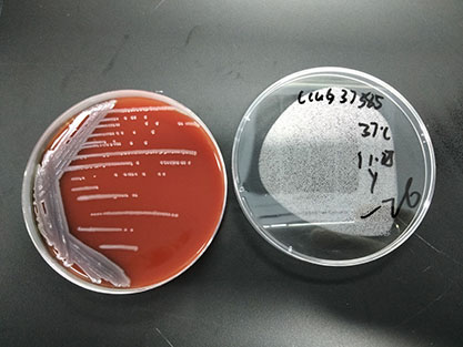 Pseudomonas aeruginosa-BNCC