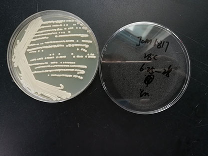 Saccharomyces cerevisiae-BNCC