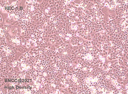 Human endometrial adenocarcinoma cells-BNCC