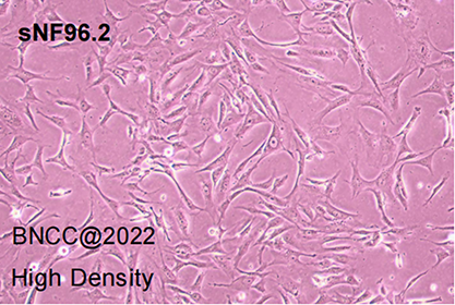 Human Schwann cells (neurofibromatosis type 1)-BNCC