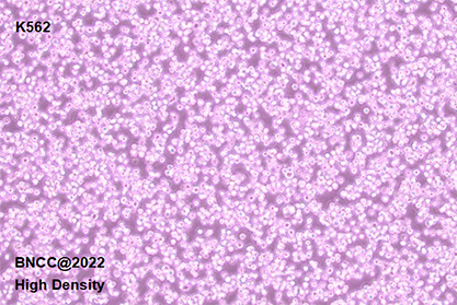 Human chronic myeloid leukemia cells-BNCC