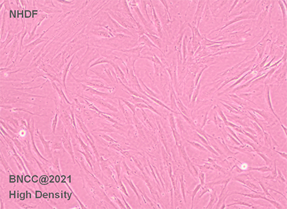 Normal human skin fibroblasts-BNCC