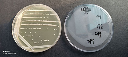 Staphylococcus epidermidis-BNCC