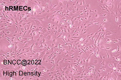 Human retinal microvascular endothelial cells-BNCC