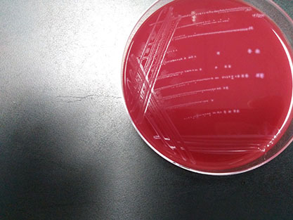 Clostridium baishi-BNCC