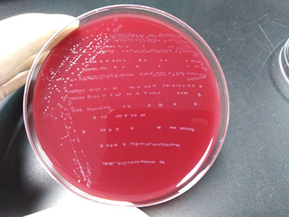 Clostridium bezelii-BNCC