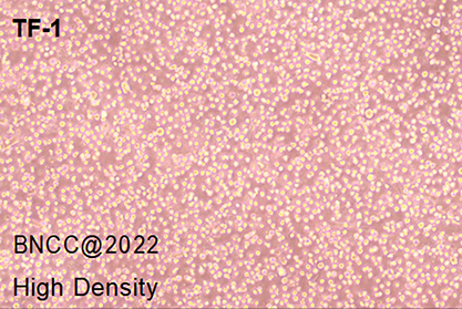 Human Erythrocyte Leukemia Lymphocytes-BNCC