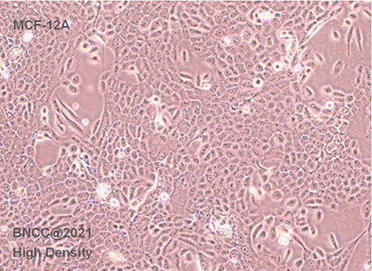 Human mammary epithelial cells-BNCC