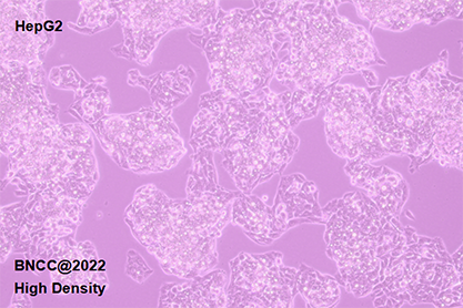 human mammary squamous carcinoma cell-BNCC
