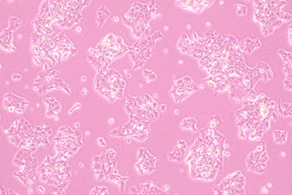 Mouse insulinoma islet a cell-BNCC