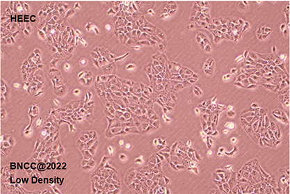 Human normal esophageal epithelial cells-BNCC