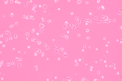 Human melanoma cells-BNCC