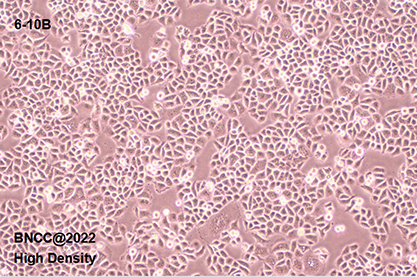Human nasopharyngeal carcinoma cells-BNCC