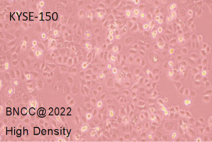 Human esophageal squamous cell carcinoma-BNCC