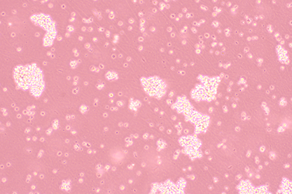 Human small cell lung cancer cells-BNCC