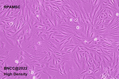 Rat pulmonary artery smooth muscle cells-BNCC