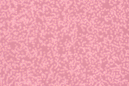 Human acute lymphoblastic leukemia cell clone G5-BNCC