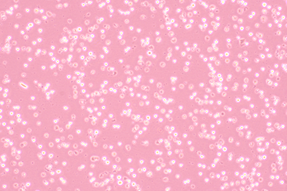 Human megakaryocytic leukemia cells-BNCC