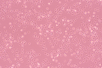 Mouse mammary epithelial cells-BNCC