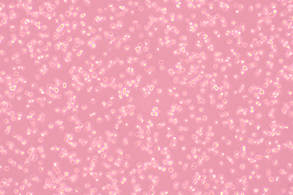 Human breast cancer epithelial cells-BNCC