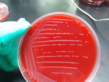 Neisseria meningitidis B-BNCC