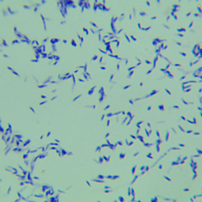 Mycobacterium intracellular-BNCC