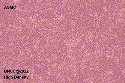 Mouse airway smooth muscle cells-BNCC