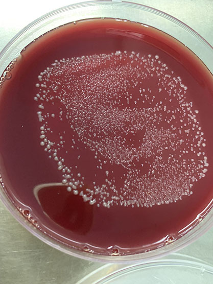 Bacteroides ovale-BNCC
