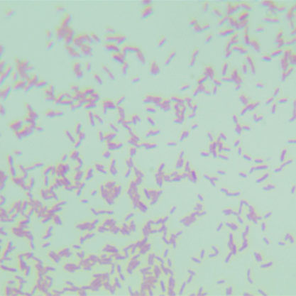 Stenotrophomonas maltophilia-BNCC