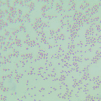 Parabacteroides distasonis-BNCC