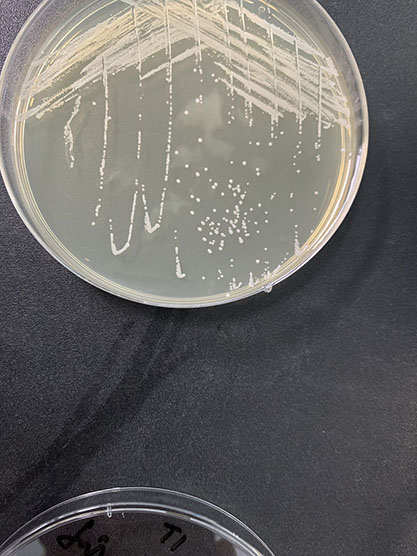 Staphylococcus epidermidis-BNCC