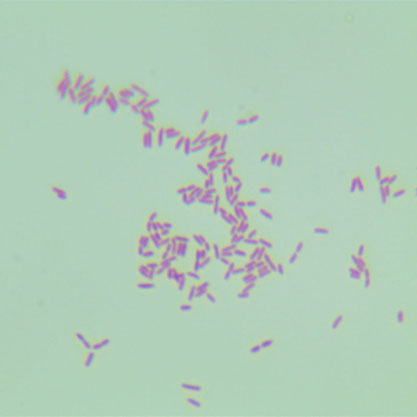 Stenotrophomonas maltophilia-BNCC